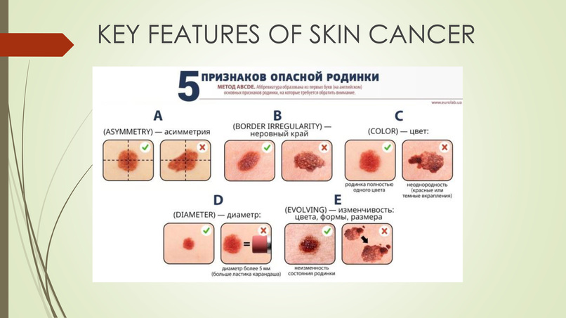 Identification of skin oncological diseases AI – screenshot 1