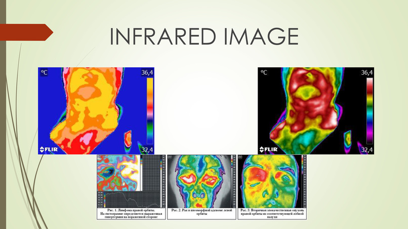 Identification of skin oncological diseases AI – screenshot 2