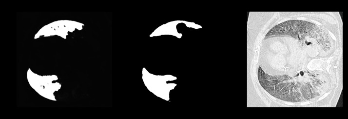 COVISEG - Segmentação de imagens de TC para casos de COVID19 – screenshot 2