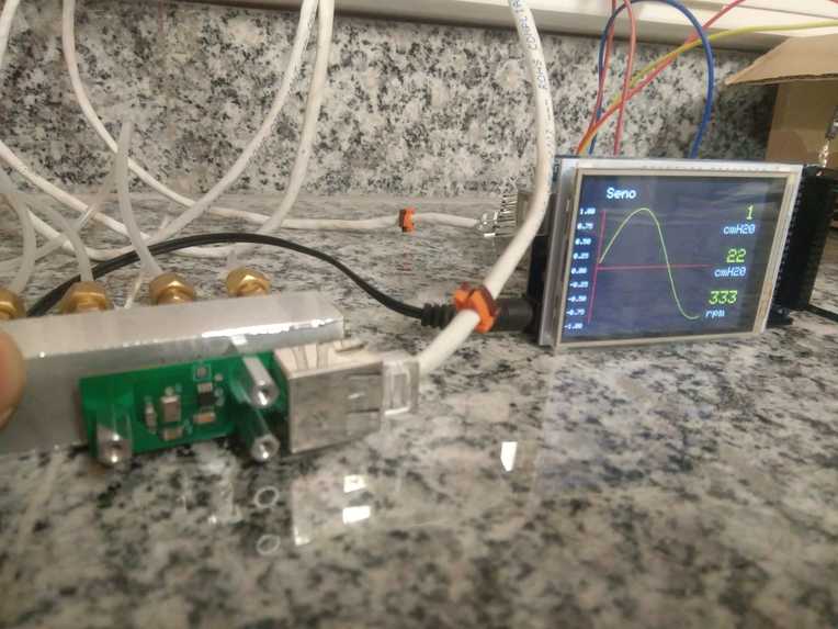U-SAVE - Unified System for Artificial Ventilator Equipment – screenshot 7