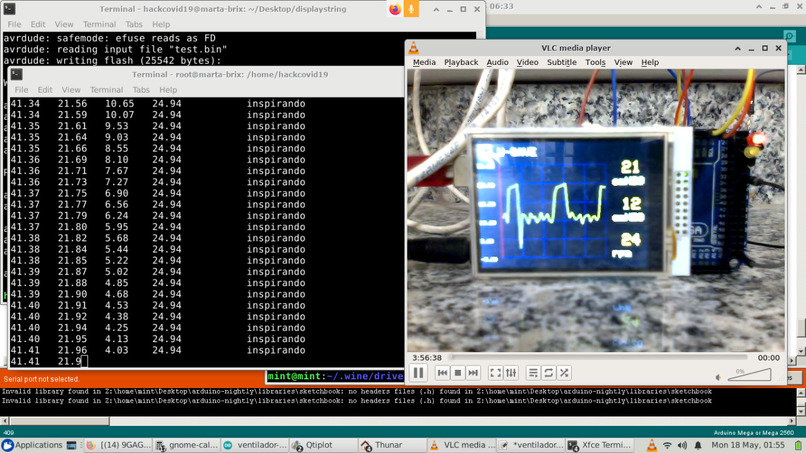 U-SAVE - Unified System for Artificial Ventilator Equipment – screenshot 9