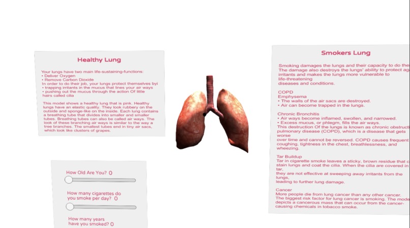 LungViewer – screenshot 1