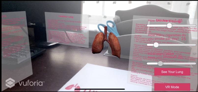 LungViewer – screenshot 2