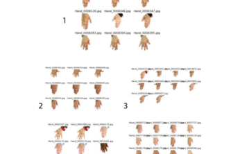 Hand-Image-Analysis