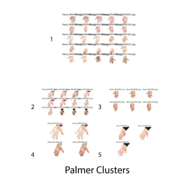 Hand-Image-Analysis – screenshot 2
