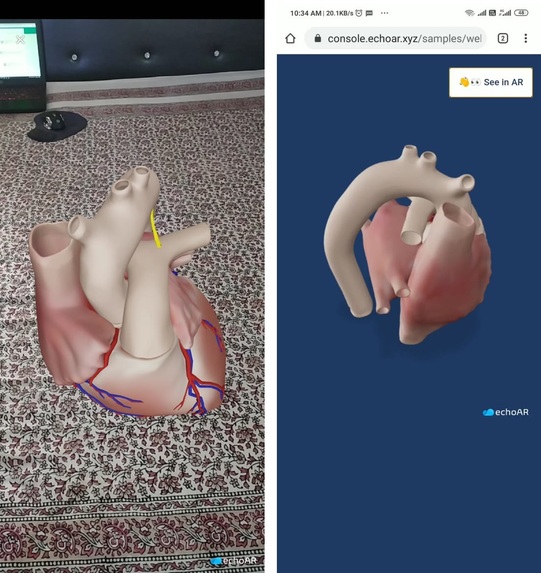 AR Anatomy – screenshot 1