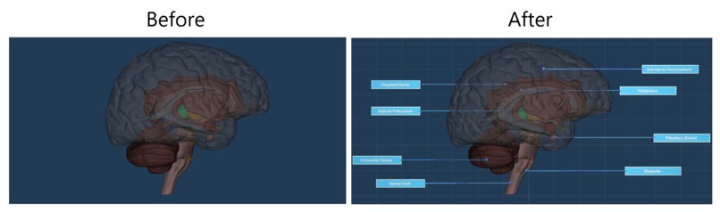 AR Anatomy – screenshot 2