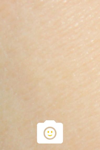 Skin Friend – screenshot 2