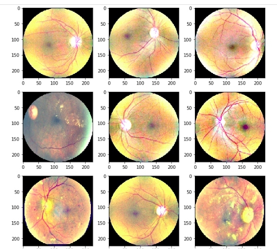 Dr. A-eye – screenshot 1