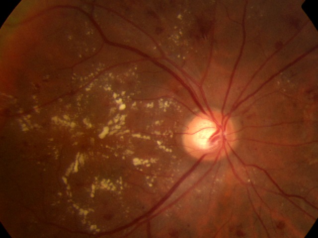 Dr. A-eye – screenshot 6
