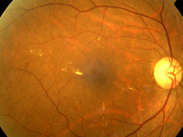 Dr. A-eye – screenshot 7