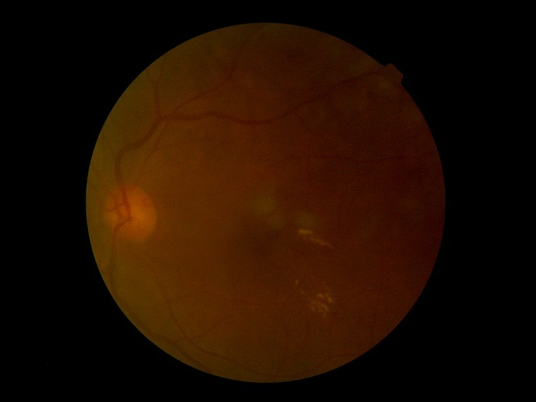 Dr. A-eye – screenshot 8
