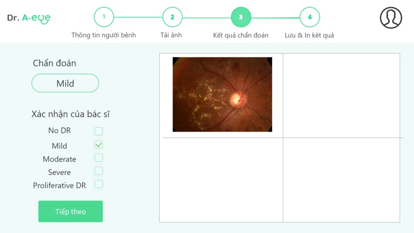 Dr. A-eye – screenshot 10