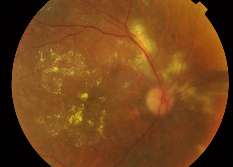 Dr. A-eye – screenshot 12