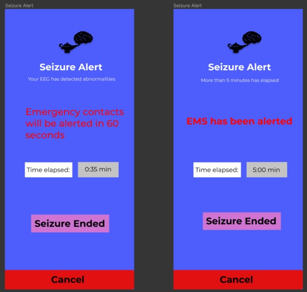 EEGenie – screenshot 3