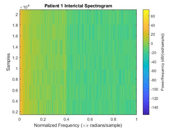 EEGenie – screenshot 7