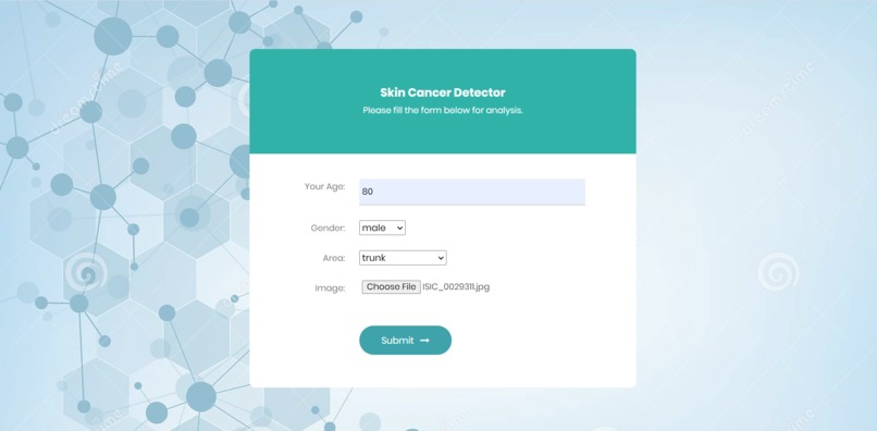 Detector – screenshot 1