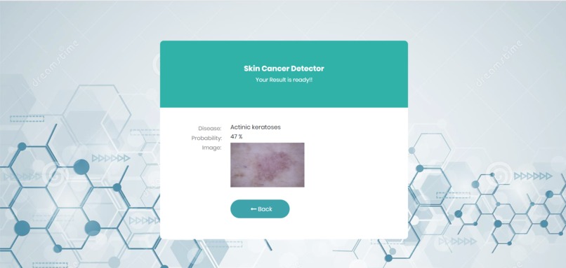 Detector – screenshot 3