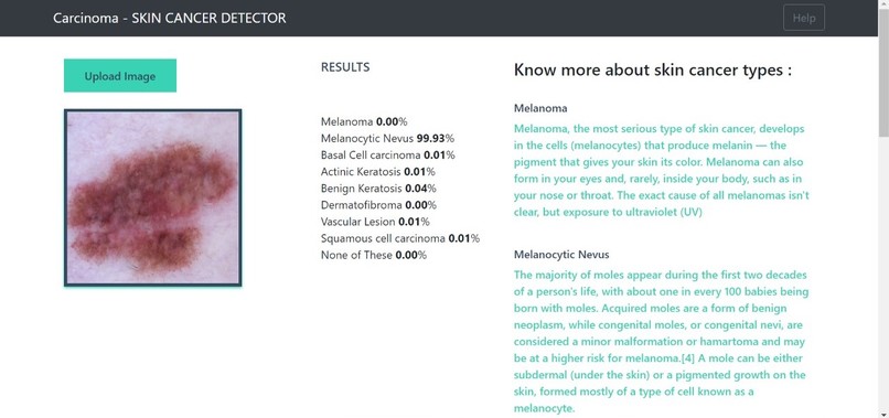 Carcinoma - Skin Cancer Detection – screenshot 1