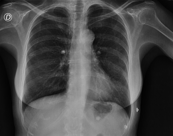 Covid Care – screenshot 2