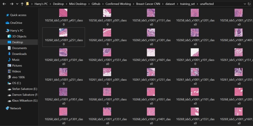 Walkers for Knockers – screenshot 6