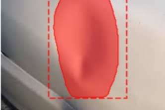 Vehicle Damage Detector