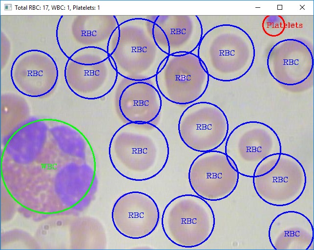HemoCount - An AI-based White Blood Cell Counting Platform – screenshot 5