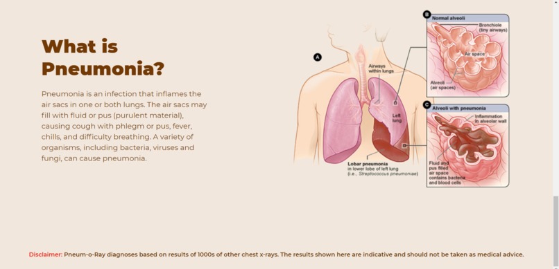 Pneum-o-Ray – screenshot 5