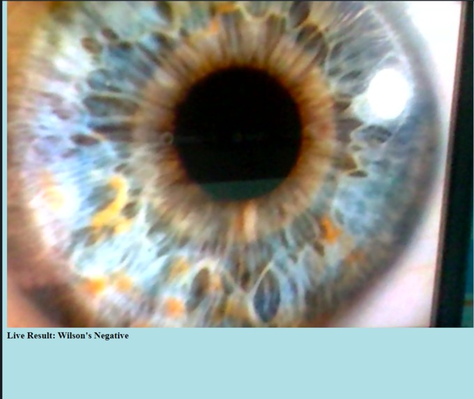 Killer Eye - Diagnosing Wilson's Disease. – screenshot 3