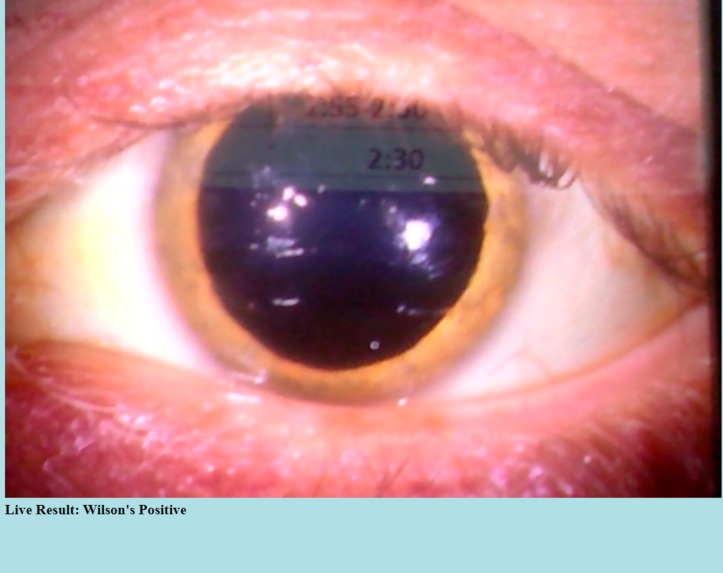 Killer Eye - Diagnosing Wilson's Disease. – screenshot 5