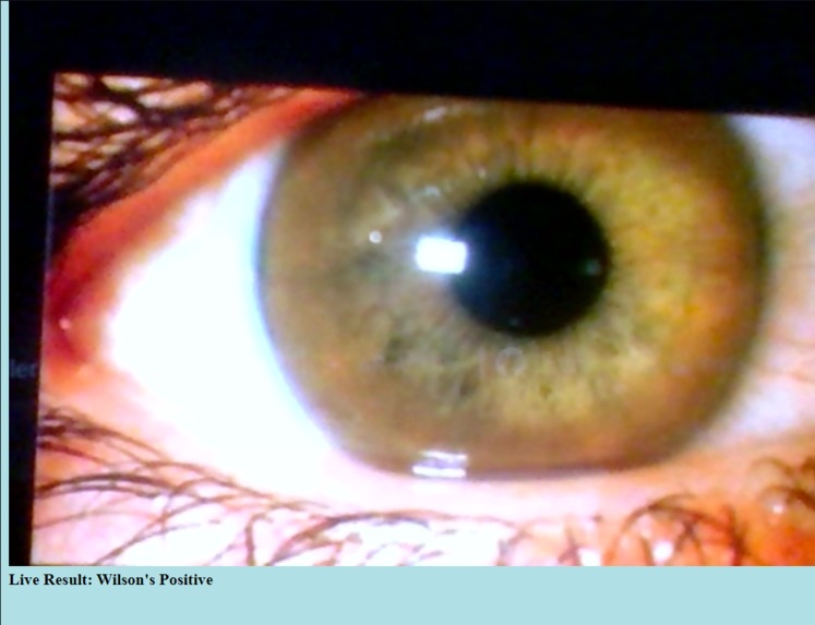 Killer Eye - Diagnosing Wilson's Disease. – screenshot 7