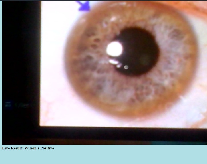 Killer Eye - Diagnosing Wilson's Disease. – screenshot 8