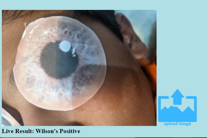 Killer Eye - Diagnosing Wilson's Disease. – screenshot 2