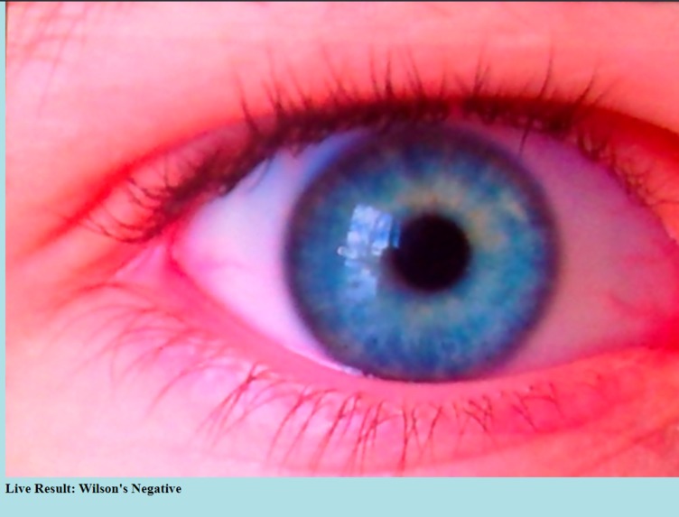 Killer Eye - Diagnosing Wilson's Disease. – screenshot 6