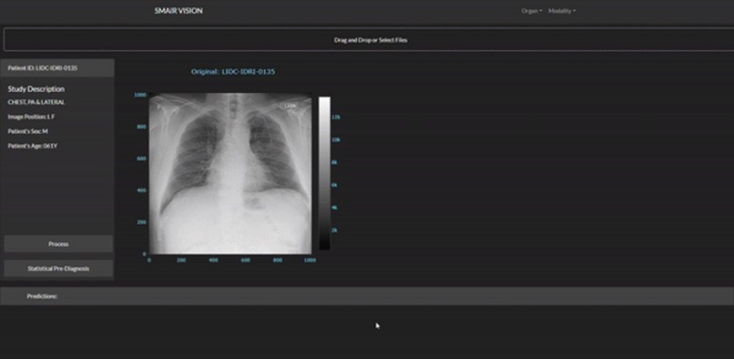 S.M.A.I.R. Vision – screenshot 1