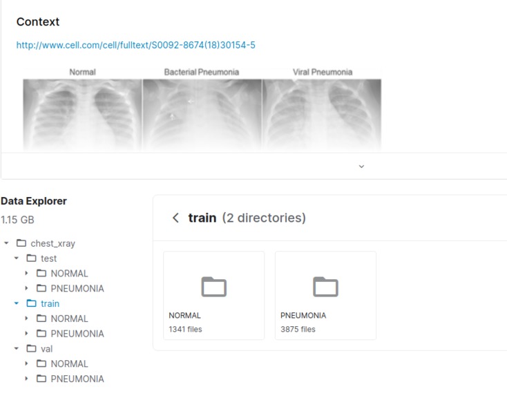 pneumonia_detection – screenshot 5
