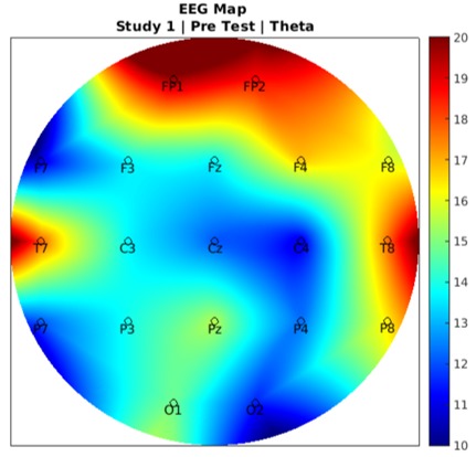 EEG_data_visualization_in_MATLAB – screenshot 1