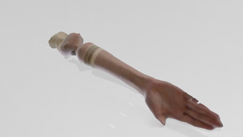CAST3D - Scanner for Medicinal Casts  – screenshot 3