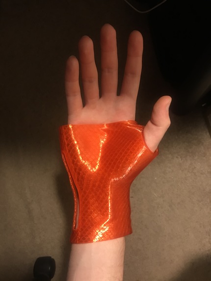 CAST3D - Scanner for Medicinal Casts  – screenshot 4