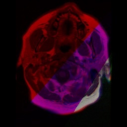 AMIP -- Andrew's Medical Image Project – screenshot 1