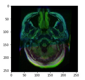 AMIP -- Andrew's Medical Image Project – screenshot 2