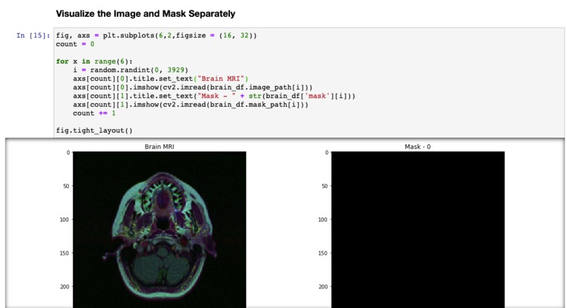 AMIP -- Andrew's Medical Image Project – screenshot 4
