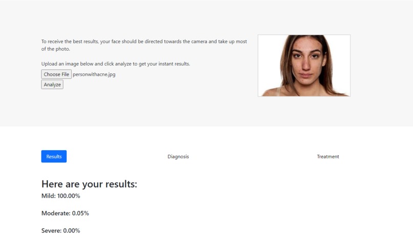NoMoAcne – screenshot 3
