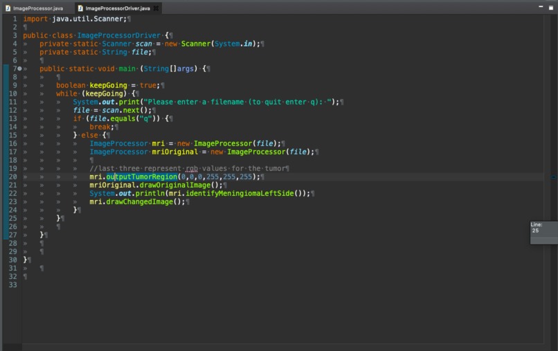 Team A - Image Processing on MRIs – screenshot 1