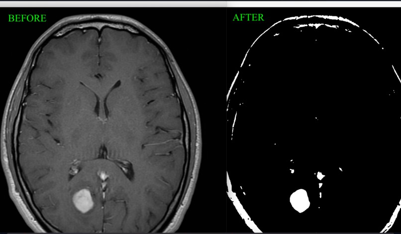 Team A - Image Processing on MRIs – screenshot 4