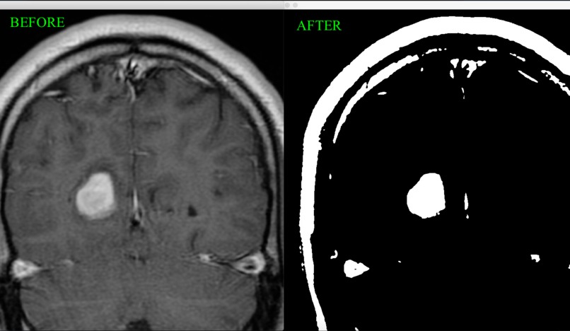 Team A - Image Processing on MRIs – screenshot 5