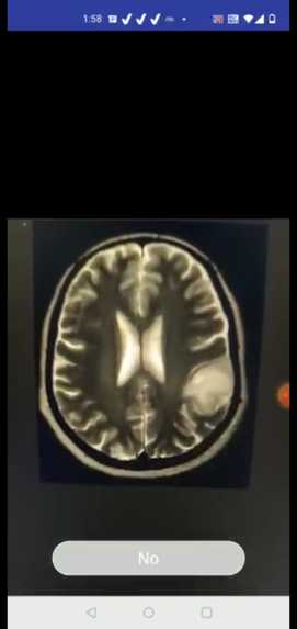 Brain Tumor Detector – screenshot 2