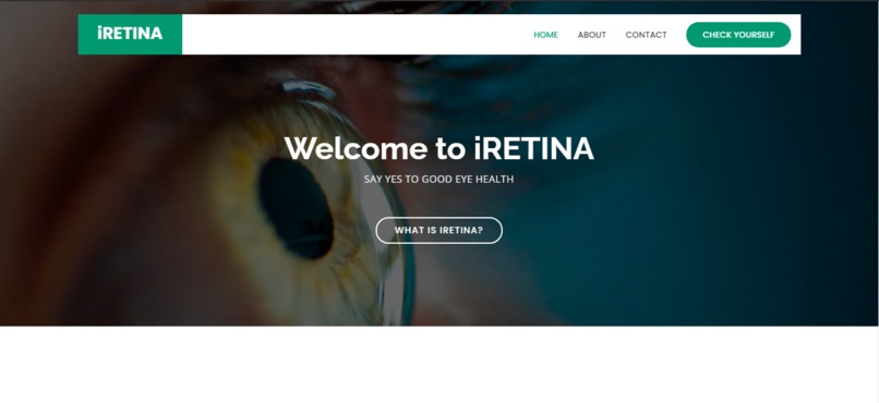 Cataract Detection – screenshot 2