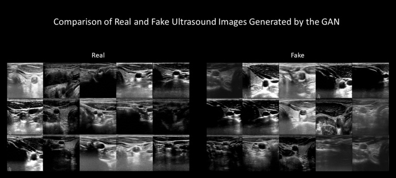 Carotid Plaque Risk Assessment – screenshot 2