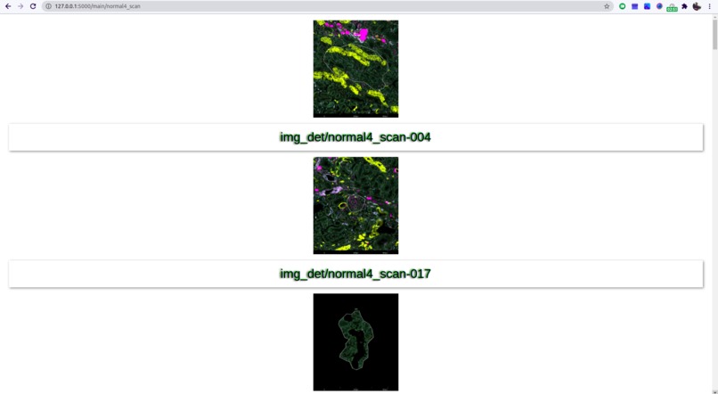 Kidney Dataset Visualisation  – screenshot 2